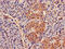 Proteasome Subunit Beta 2 antibody, LS-C211111, Lifespan Biosciences, Immunohistochemistry frozen image 