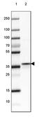 Fructose-Bisphosphatase 2 antibody, PA5-52943, Invitrogen Antibodies, Western Blot image 