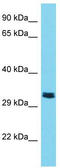 Transmembrane Serine Protease 9 antibody, TA331538, Origene, Western Blot image 