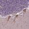Zinc Finger Protein 337 antibody, NBP2-49413, Novus Biologicals, Immunohistochemistry paraffin image 