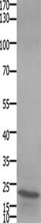 Stathmin-2 antibody, TA322450, Origene, Western Blot image 