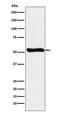 Lumican antibody, M01034-1, Boster Biological Technology, Western Blot image 