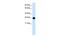 14-3-3 Eta antibody, PA5-46811, Invitrogen Antibodies, Western Blot image 