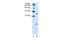 Vacuolar ATPase Assembly Factor VMA21 antibody, A08387, Boster Biological Technology, Western Blot image 