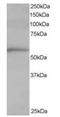 ADAMTS-like protein 2 antibody, orb18647, Biorbyt, Western Blot image 