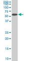 Aladin WD Repeat Nucleoporin antibody, LS-B6169, Lifespan Biosciences, Western Blot image 