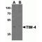 T Cell Immunoglobulin And Mucin Domain Containing 4 antibody, TA306323, Origene, Western Blot image 