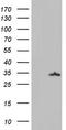 Galectin 3 antibody, LS-C339279, Lifespan Biosciences, Western Blot image 