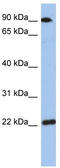 Transmembrane P24 Trafficking Protein 10 antibody, TA344225, Origene, Western Blot image 