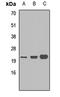 S100 Calcium Binding Protein A9 antibody, orb412901, Biorbyt, Western Blot image 