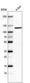 Cyclin Dependent Kinase Like 5 antibody, NBP2-61145, Novus Biologicals, Western Blot image 