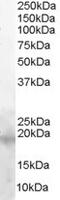 Baculoviral IAP Repeat Containing 5 antibody, AHP2075, Bio-Rad (formerly AbD Serotec) , Western Blot image 