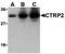C1q And TNF Related 2 antibody, 3671, ProSci, Western Blot image 