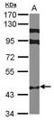 Zinc Finger Protein 384 antibody, GTX101975, GeneTex, Western Blot image 