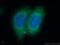 Complement Component 4 Binding Protein Beta antibody, 15837-1-AP, Proteintech Group, Immunofluorescence image 