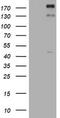 ALK Receptor Tyrosine Kinase antibody, TA801198AM, Origene, Western Blot image 