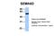 Semaphorin 6D antibody, PA5-43381, Invitrogen Antibodies, Western Blot image 