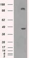 Lysyl Oxidase antibody, LS-C114929, Lifespan Biosciences, Western Blot image 