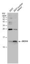 Mediator Complex Subunit 10 antibody, GTX131860, GeneTex, Western Blot image 