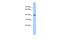 Short-chain specific acyl-CoA dehydrogenase, mitochondrial antibody, A05028, Boster Biological Technology, Western Blot image 