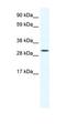 SRY-Box 12 antibody, orb324469, Biorbyt, Western Blot image 