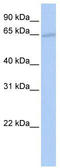 Transcriptional repressor p66-beta antibody, TA331823, Origene, Western Blot image 