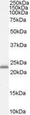 Retinol Binding Protein 4 antibody, GTX89148, GeneTex, Western Blot image 