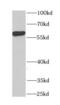 Chaperonin Containing TCP1 Subunit 4 antibody, FNab01399, FineTest, Western Blot image 