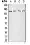 Adenylate Cyclase 4 antibody, LS-B13652, Lifespan Biosciences, Western Blot image 