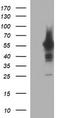 Tyrosine Hydroxylase antibody, TA506549BM, Origene, Western Blot image 