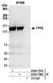 Tripeptidyl Peptidase 2 antibody, A304-758A, Bethyl Labs, Immunoprecipitation image 