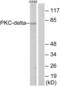 Heat Shock Transcription Factor 1 antibody, LS-B7569, Lifespan Biosciences, Western Blot image 