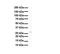 Methyltransferase Like 11B antibody, A15877, Boster Biological Technology, Western Blot image 