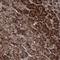 Coiled-Coil Serine Rich Protein 2 antibody, NBP1-81438, Novus Biologicals, Immunohistochemistry frozen image 