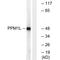 Protein Phosphatase, Mg2+/Mn2+ Dependent 1L antibody, A11054, Boster Biological Technology, Western Blot image 