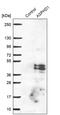 Aspartate Beta-Hydroxylase Domain Containing 1 antibody, PA5-60942, Invitrogen Antibodies, Western Blot image 