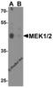 Mitogen-Activated Protein Kinase Kinase 1 antibody, 8207, ProSci, Western Blot image 