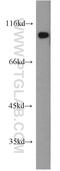 PDE6B antibody, 22063-1-AP, Proteintech Group, Western Blot image 