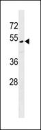 Centromere Protein U antibody, 59-196, ProSci, Western Blot image 