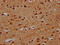 PR/SET Domain 11 antibody, LS-C681117, Lifespan Biosciences, Immunohistochemistry paraffin image 