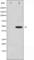 Jun Proto-Oncogene, AP-1 Transcription Factor Subunit antibody, abx012200, Abbexa, Western Blot image 