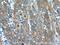 Matrix Metallopeptidase 1 antibody, 10371-2-AP, Proteintech Group, Immunohistochemistry frozen image 