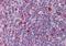 TYRO Protein Tyrosine Kinase Binding Protein antibody, NBP1-52376, Novus Biologicals, Immunohistochemistry frozen image 