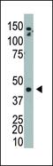 Adenosine Kinase antibody, PA5-13859, Invitrogen Antibodies, Western Blot image 