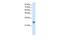 Transcription Factor A, Mitochondrial antibody, GTX77852, GeneTex, Western Blot image 