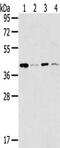 MAGE Family Member A11 antibody, CSB-PA939225, Cusabio, Western Blot image 