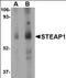 STEAP Family Member 1 antibody, orb89162, Biorbyt, Western Blot image 