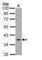 Protein Kinase AMP-Activated Non-Catalytic Subunit Gamma 2 antibody, PA5-21998, Invitrogen Antibodies, Western Blot image 