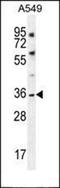 TWIK1 antibody, orb30161, Biorbyt, Western Blot image 