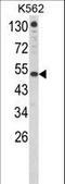 Interferon Alpha And Beta Receptor Subunit 1 antibody, LS-C165129, Lifespan Biosciences, Western Blot image 